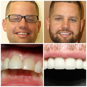 Simply Dental in Fishers, IN